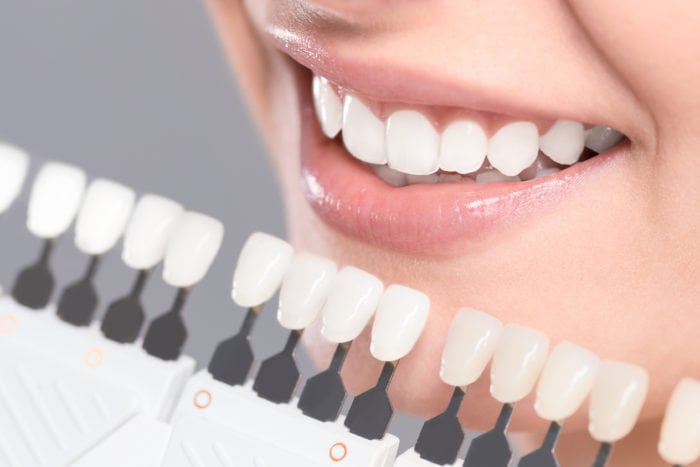 teeth whitening in Sliver Spring MD from Dechter and Moy