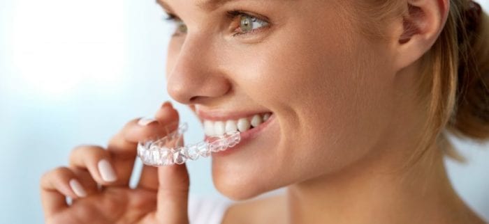 Clear Aligners in Silver Spring Maryland
