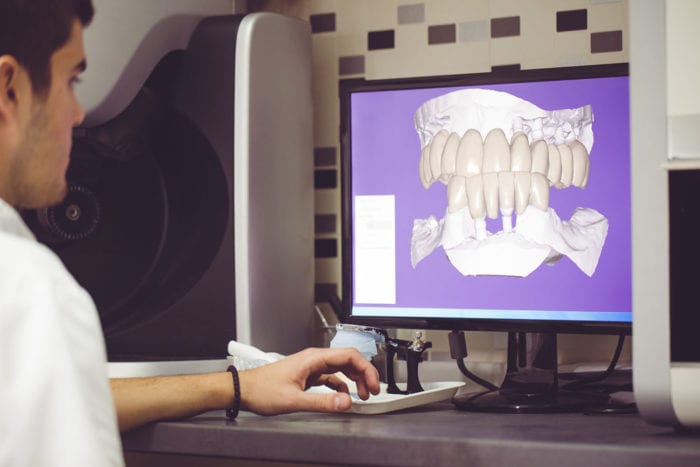 cerec same day crowns