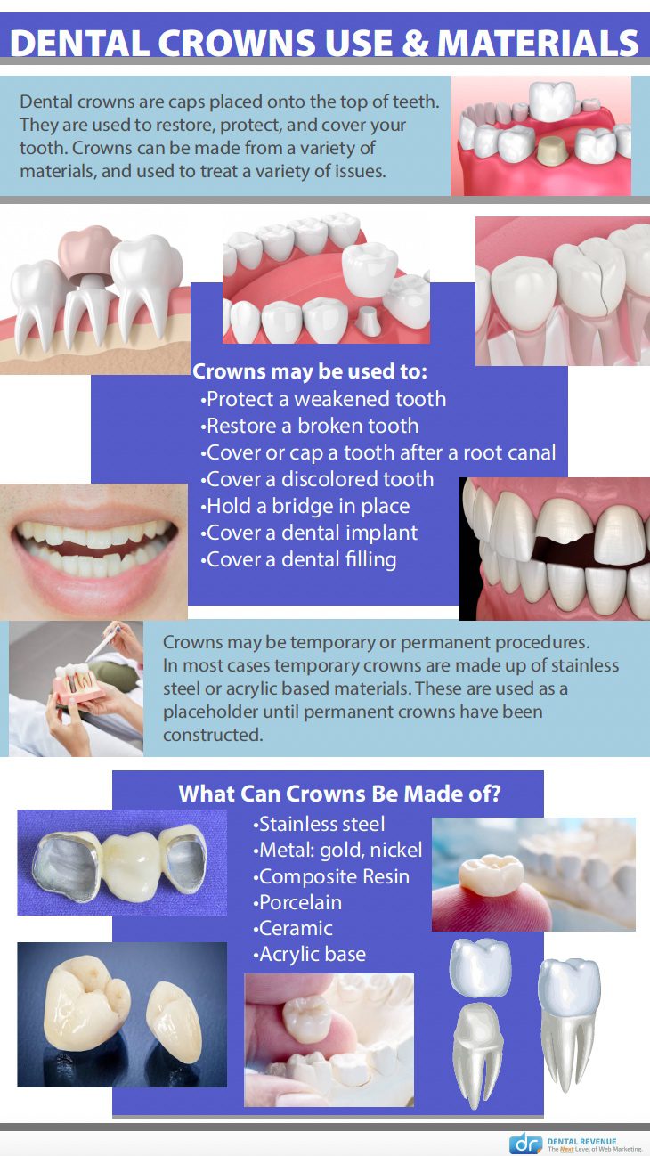 Dechter Dental Crowns Use and Materials infographic