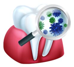 causes of gum disease