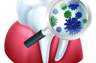 causes of gum disease