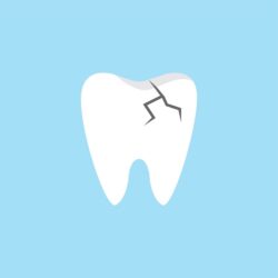 Can You Fracture a Tooth