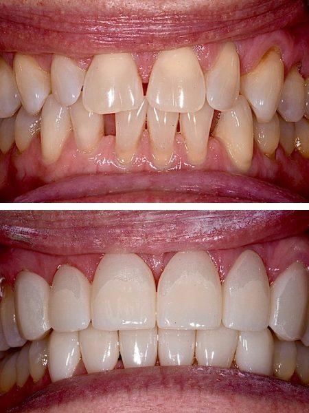 Before and after cosmetic treatment silver spring