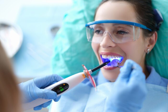 Tooth Bonding in Silver Spring MD
