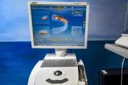 Dental imaging workstation with a computer monitor displaying a 3D digital scan of a dental arch.