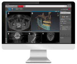 Computer monitor displaying advanced dental imaging software showing panoramic X-rays, 3D jaw reconstruction, and cross-sectional views.